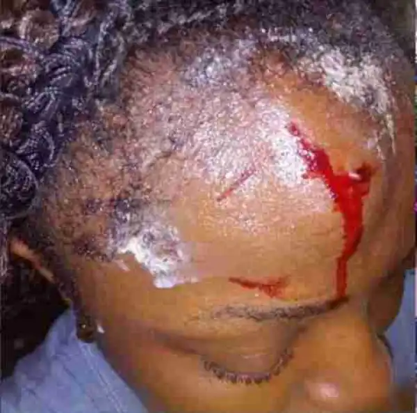 UNN Students Allegedly Brutalized, Abused and Thrown Out of the Hostel in Enugu State (Photos)